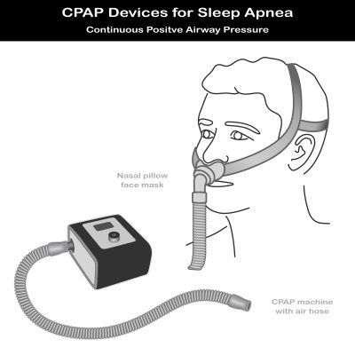CPAP machine with air hose, nasal pillow face mask on model. Continuous positive air pressure for treatment of sleep apnea and hypopnea.